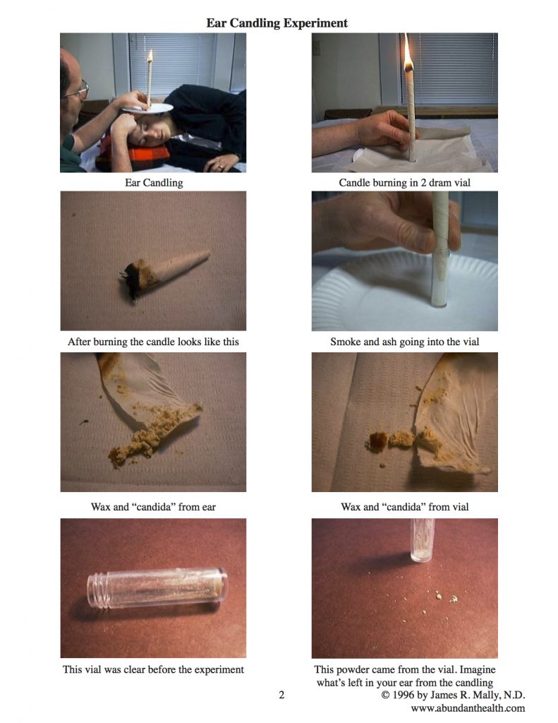 Ear Candling Experiment - Massage Library